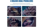 1-3X Pet Dental Tartar Remover Spray, Dog Cat Foam Teeth Clean Breath Freshener