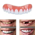 1 Pair Dental Teeth Model – Upper & Lower Jaw Demonstration Denture Set, Realistic Oral Anatomy Teaching Model for Dental Education, Students & Classroom Display