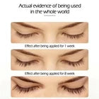 Eyelash Growth Serum & Conditioning Treatment – Nourishing Lash Care Serum for Fuller-Looking, Longer & Healthier-Looking Eyelashes